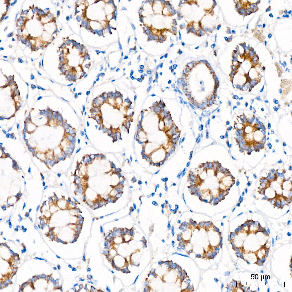 MTCO1 Rabbit mAb