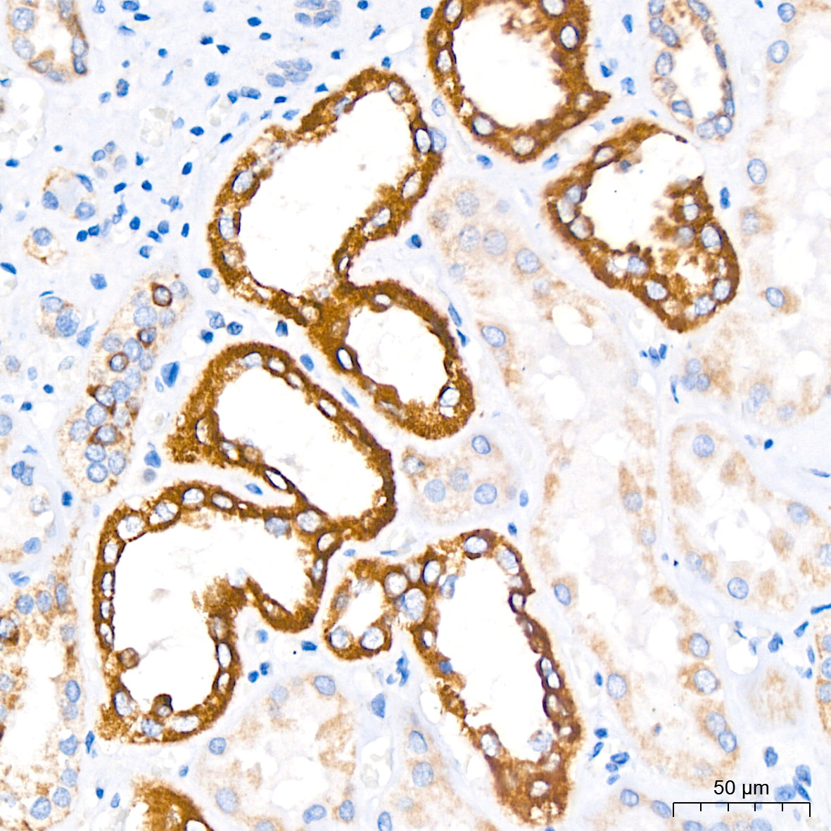 MTCO1 Rabbit mAb