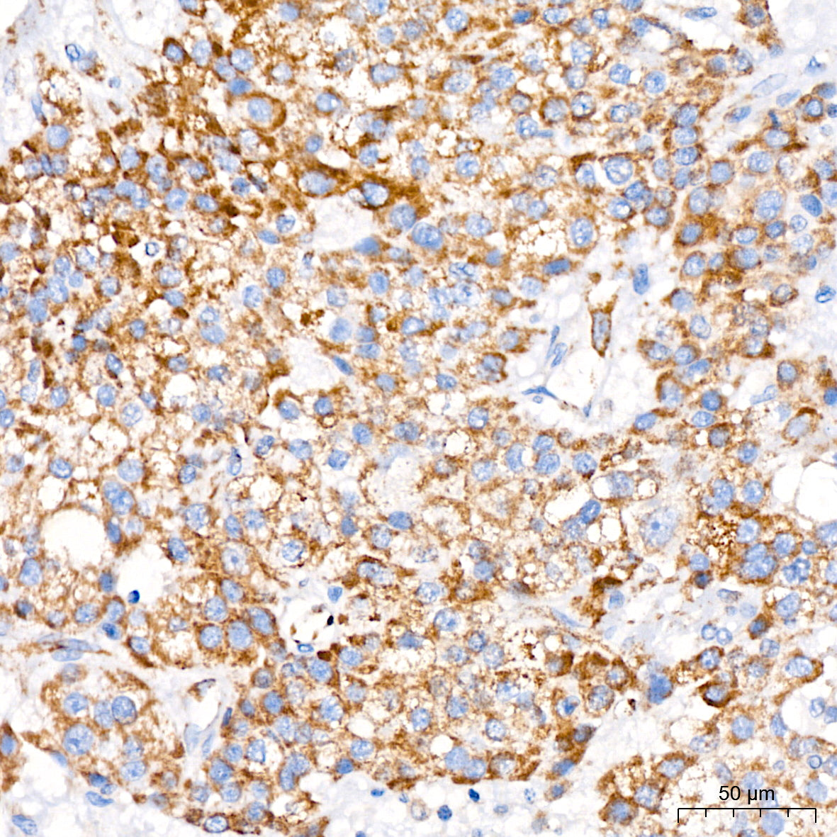 MTCO1 Rabbit mAb