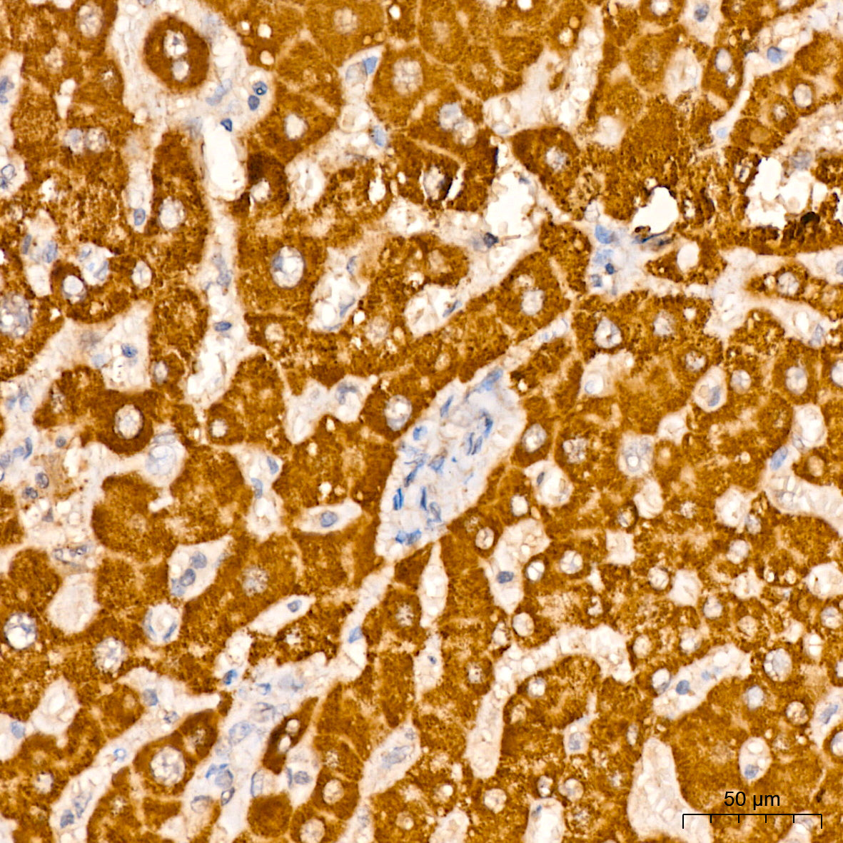 CPS1 Rabbit mAb