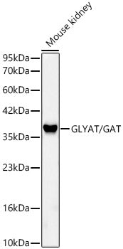 GLYAT/GAT Rabbit mAb
