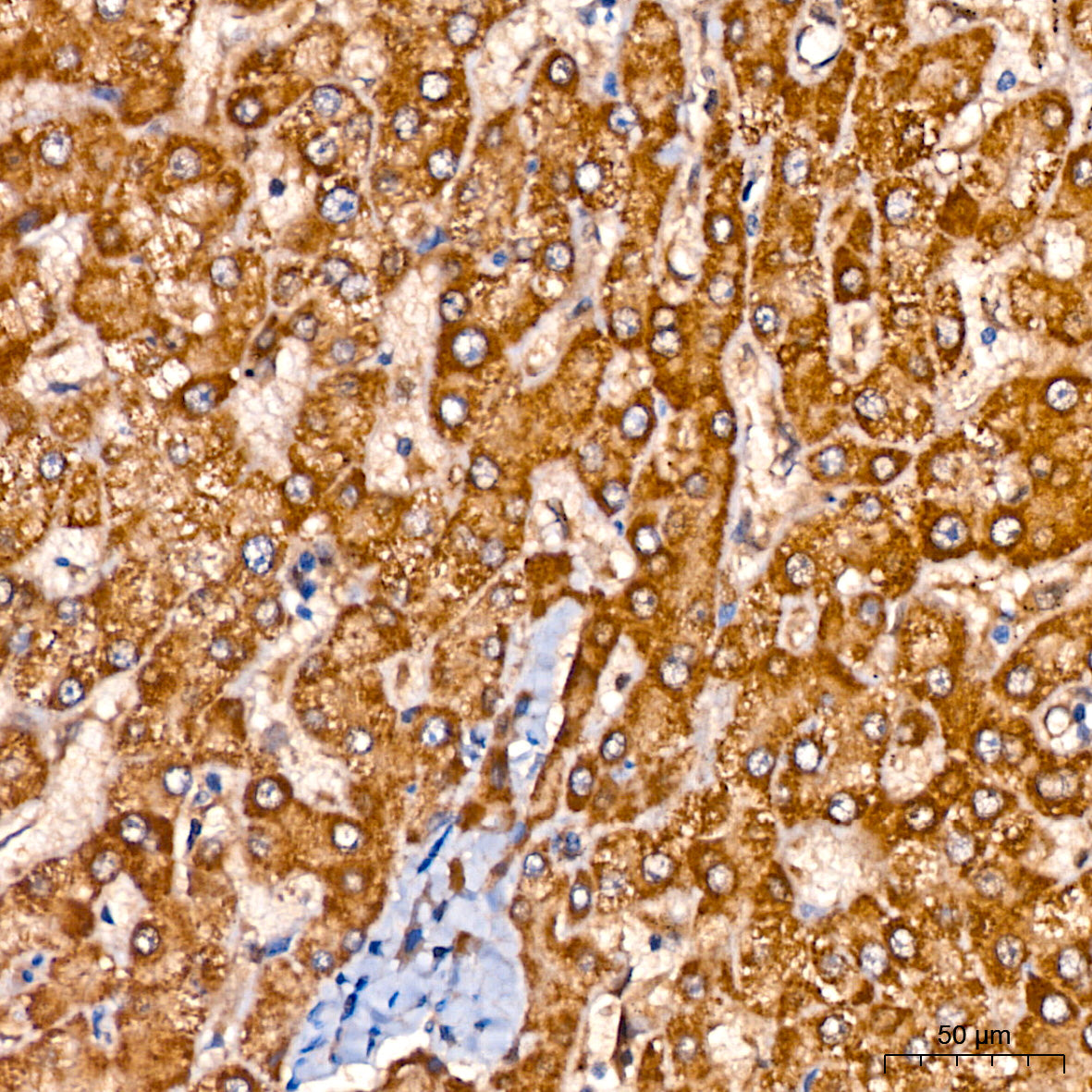 GLYAT/GAT Rabbit mAb