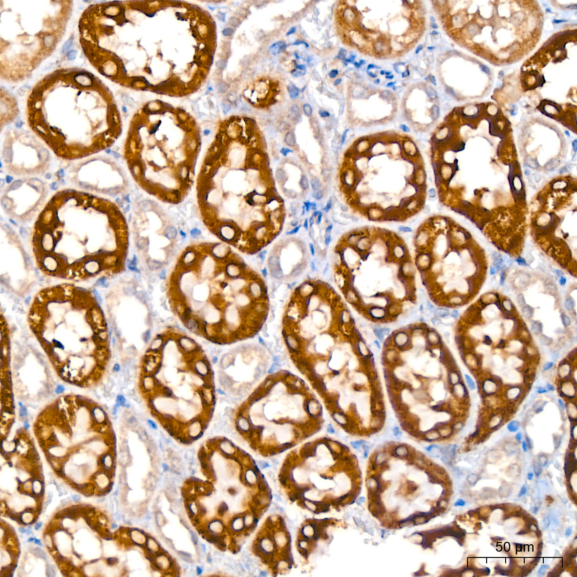 GLYAT/GAT Rabbit mAb