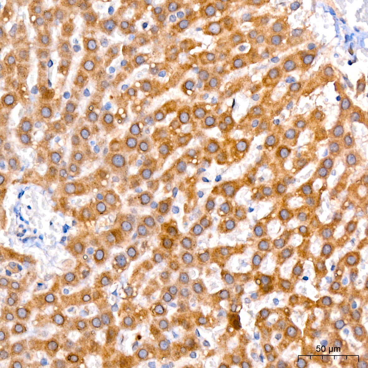 GLYAT/GAT Rabbit mAb