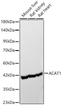 ACAT1 Rabbit mAb