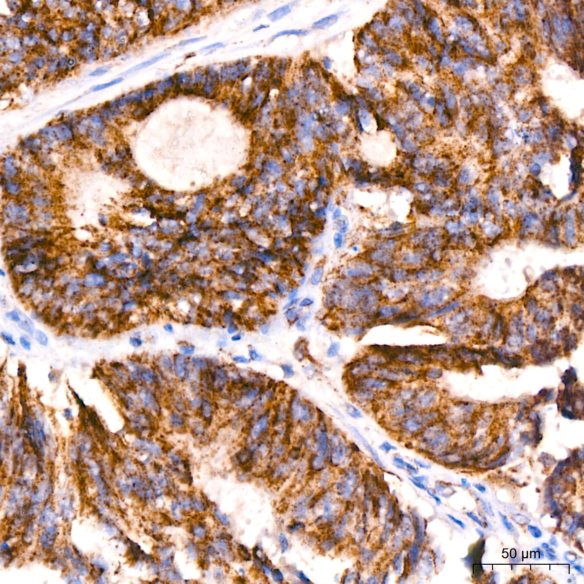 ACAT1 Rabbit mAb