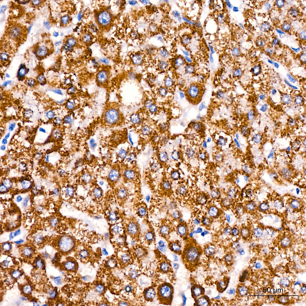ACAT1 Rabbit mAb