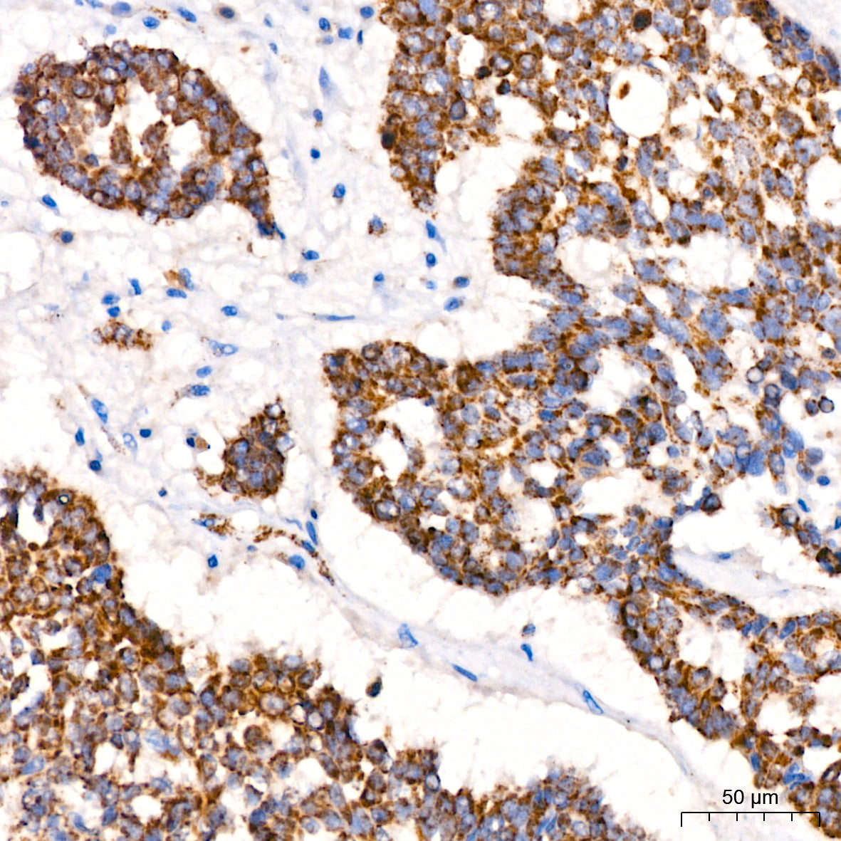 ACAT1 Rabbit mAb