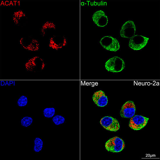 ACAT1 Rabbit mAb