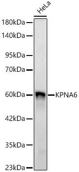 KPNA6 Rabbit mAb