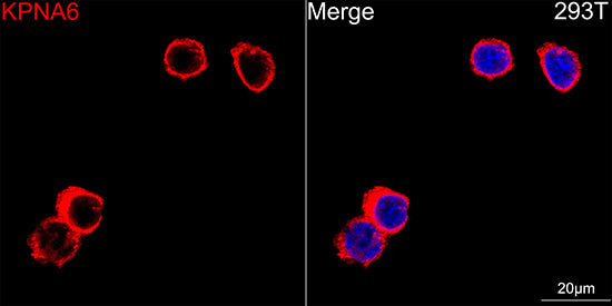 KPNA6 Rabbit mAb