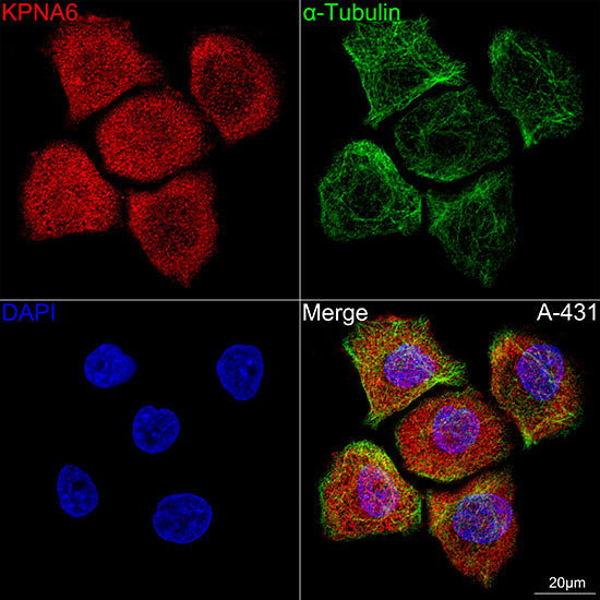 KPNA6 Rabbit mAb