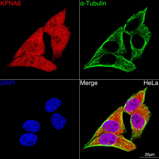 KPNA6 Rabbit mAb