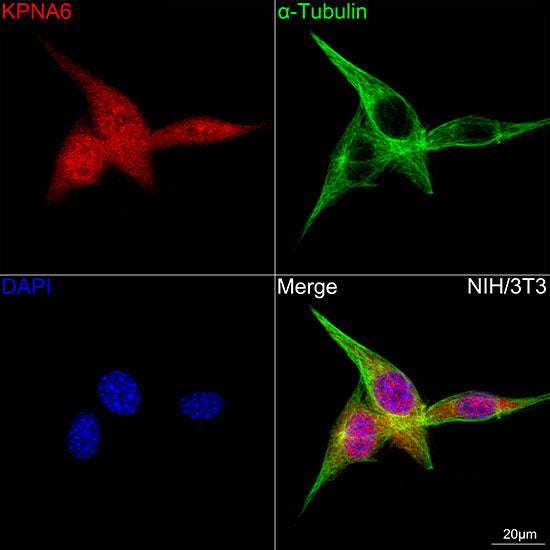 KPNA6 Rabbit mAb