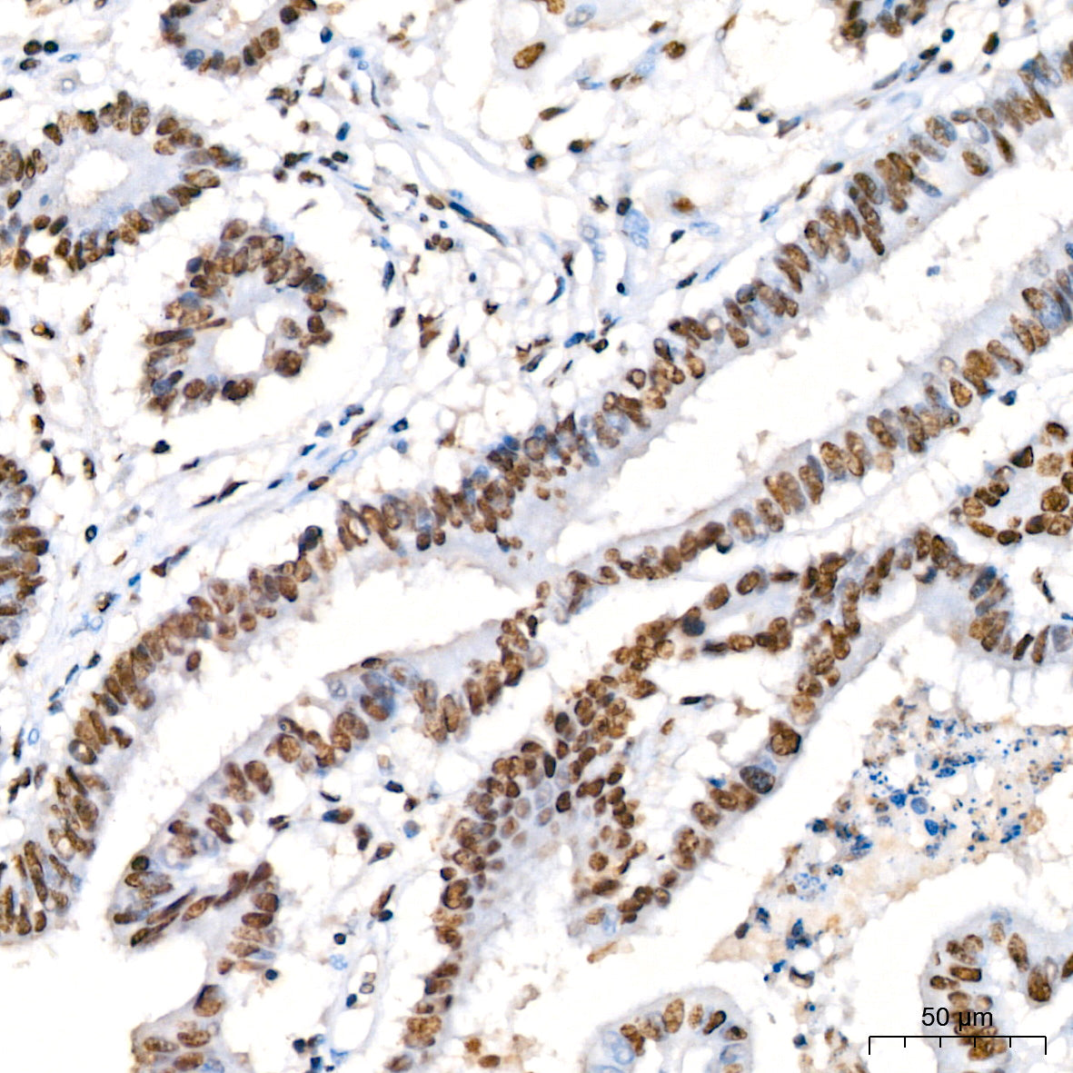 KPNA6 Rabbit mAb