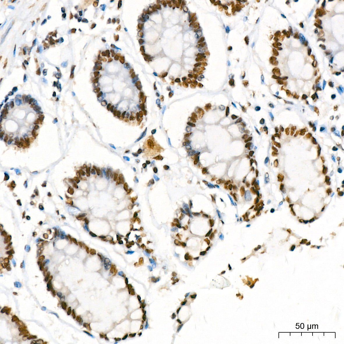 KPNA6 Rabbit mAb