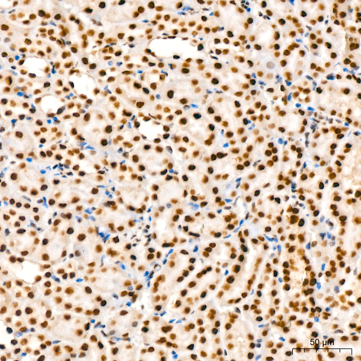 KPNA6 Rabbit mAb