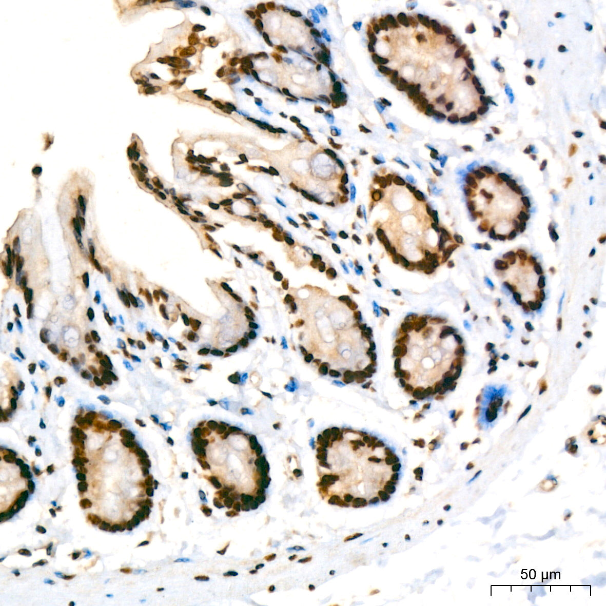KPNA6 Rabbit mAb