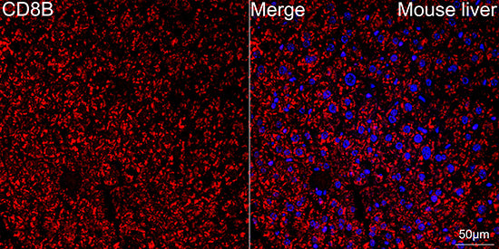 CD8β Rabbit mAb