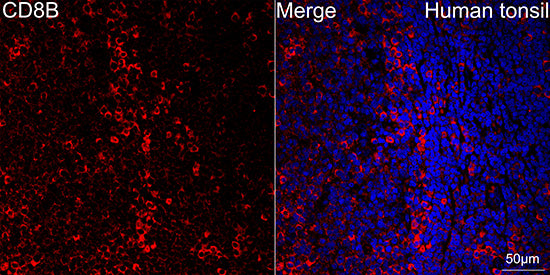 CD8β Rabbit mAb