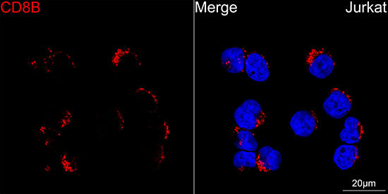 CD8β Rabbit mAb