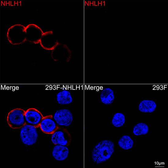 NHLH1 Rabbit mAb