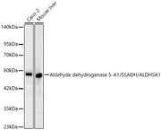 Aldehyde dehydrogenase 5-A1/SSADH/ALDH5A1  Rabbit mAb