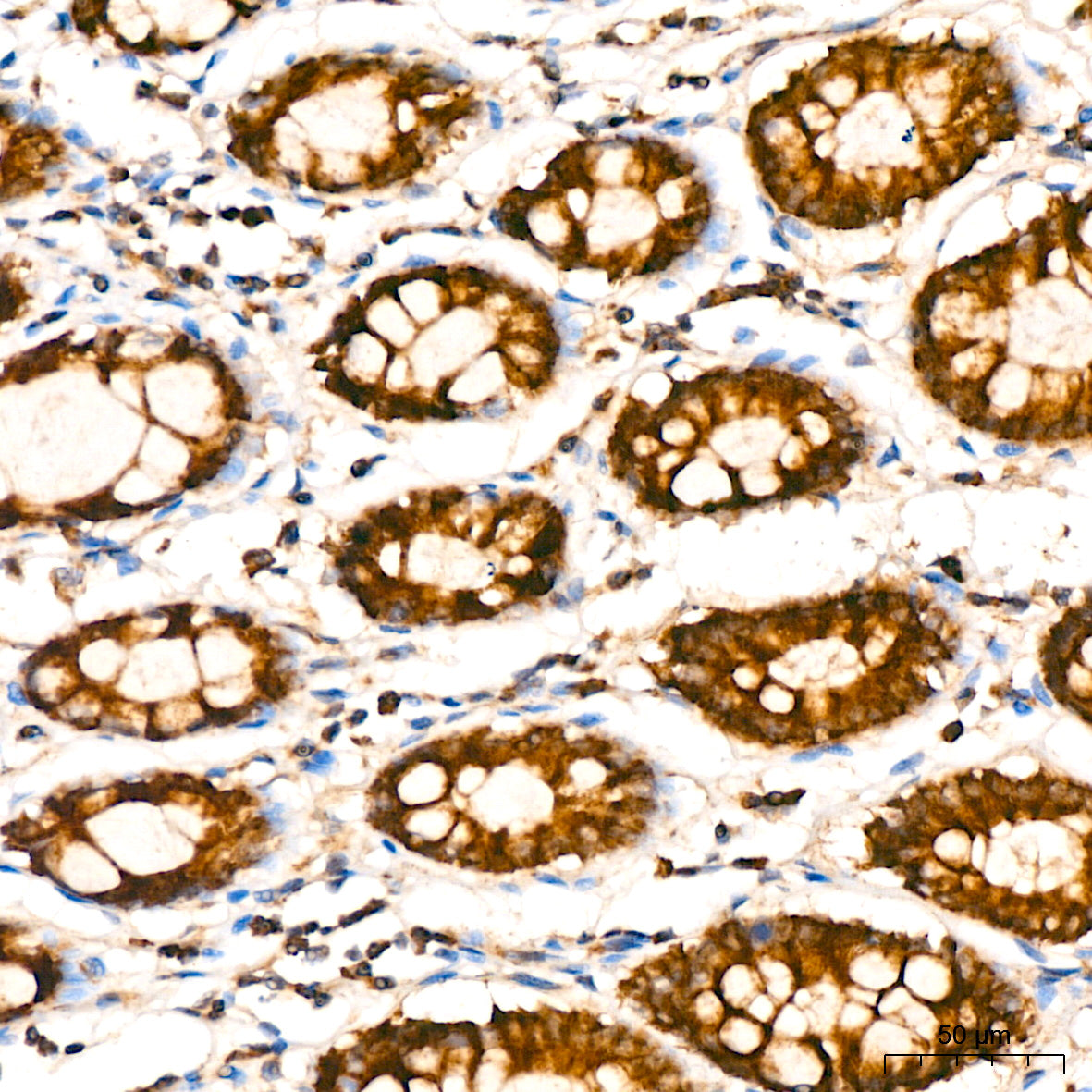 Aldehyde dehydrogenase 5-A1/SSADH/ALDH5A1  Rabbit mAb