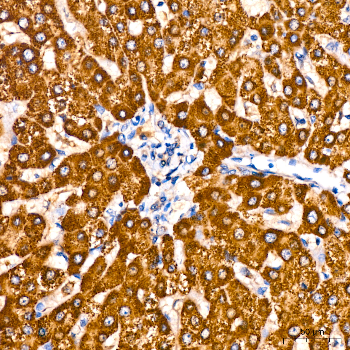 Aldehyde dehydrogenase 5-A1/SSADH/ALDH5A1  Rabbit mAb