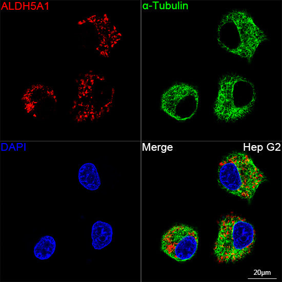 Aldehyde dehydrogenase 5-A1/SSADH/ALDH5A1  Rabbit mAb