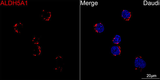 Aldehyde dehydrogenase 5-A1/SSADH/ALDH5A1  Rabbit mAb