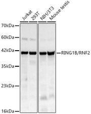 RING1B/RNF2 Rabbit mAb