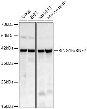 RING1B/RNF2 Rabbit mAb