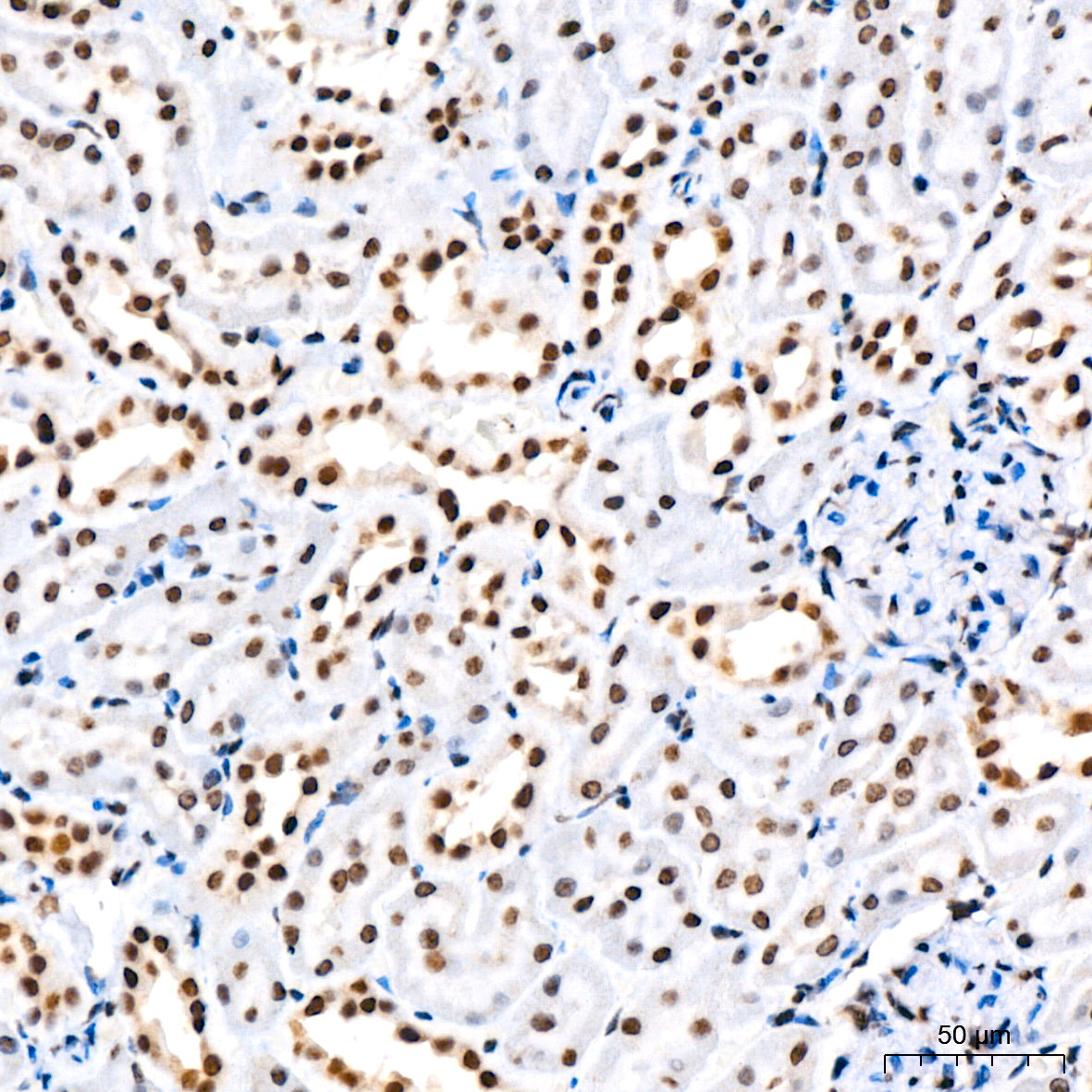 RING1B/RNF2 Rabbit mAb