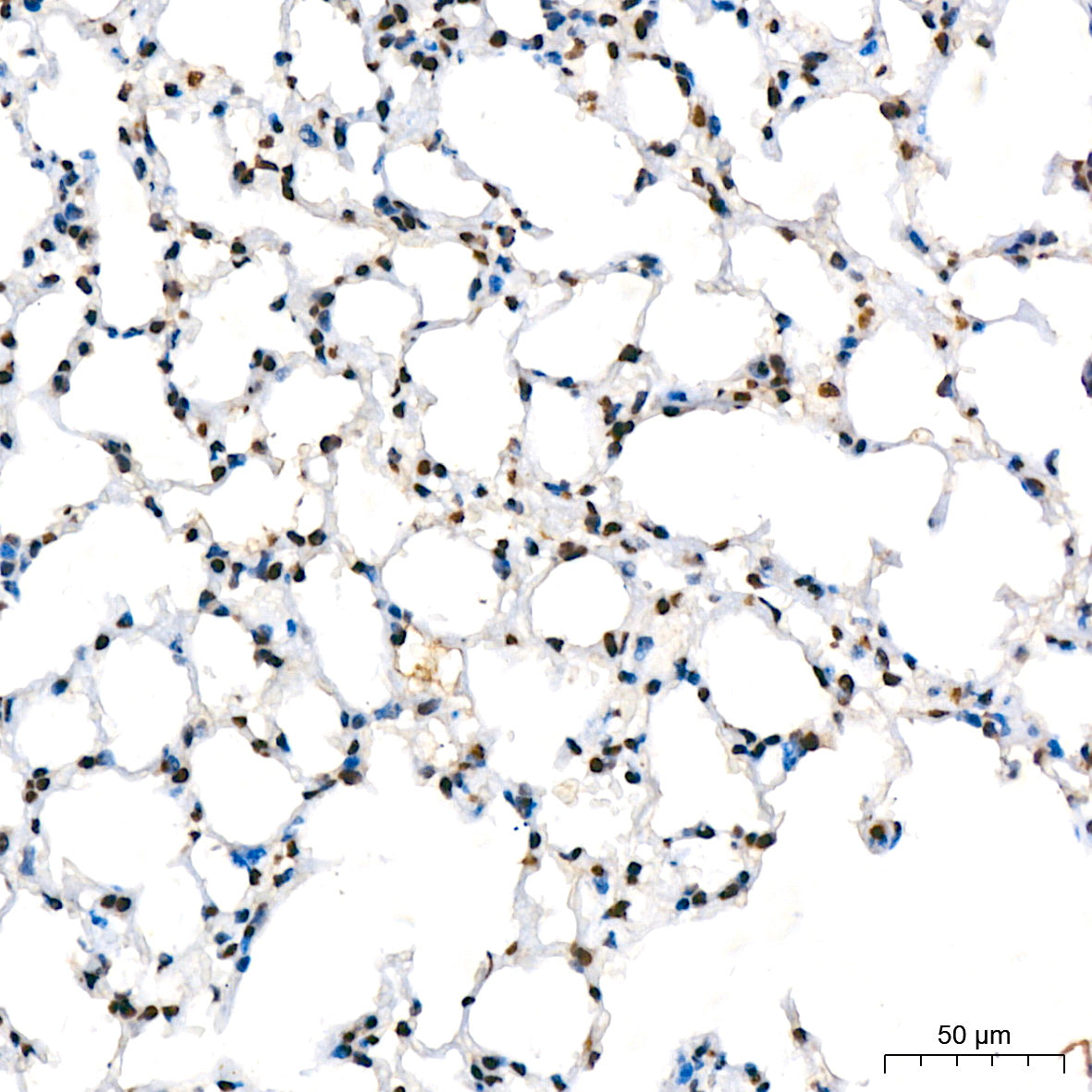 RING1B/RNF2 Rabbit mAb