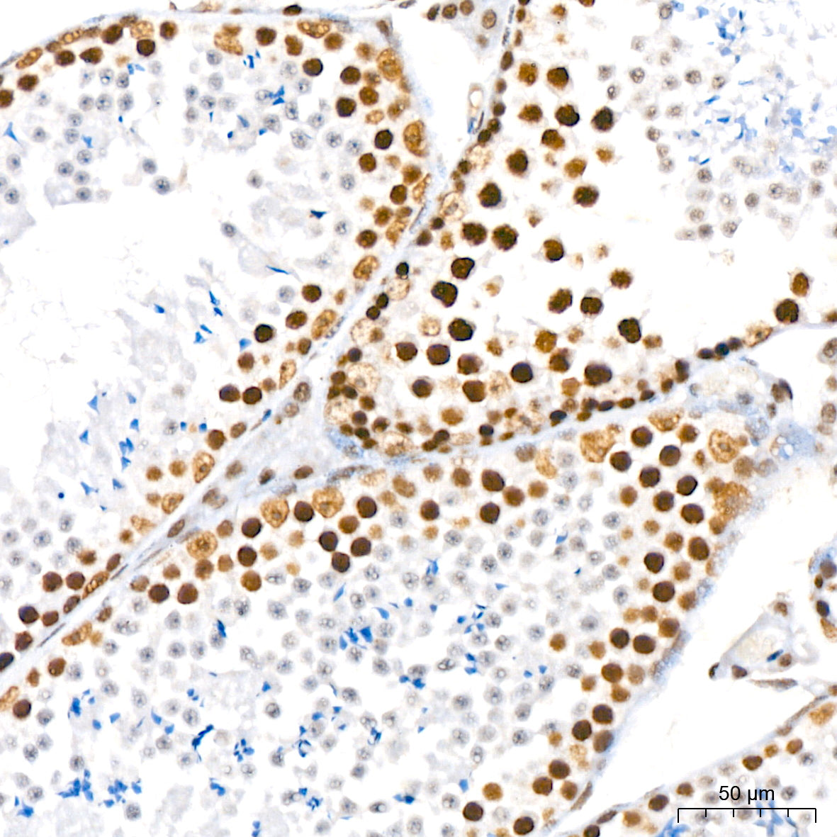 RING1B/RNF2 Rabbit mAb