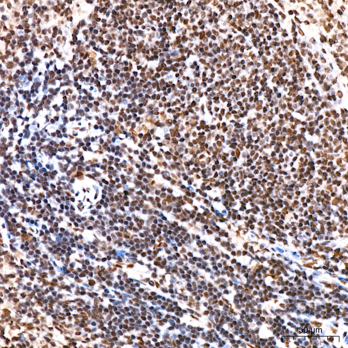RING1B/RNF2 Rabbit mAb