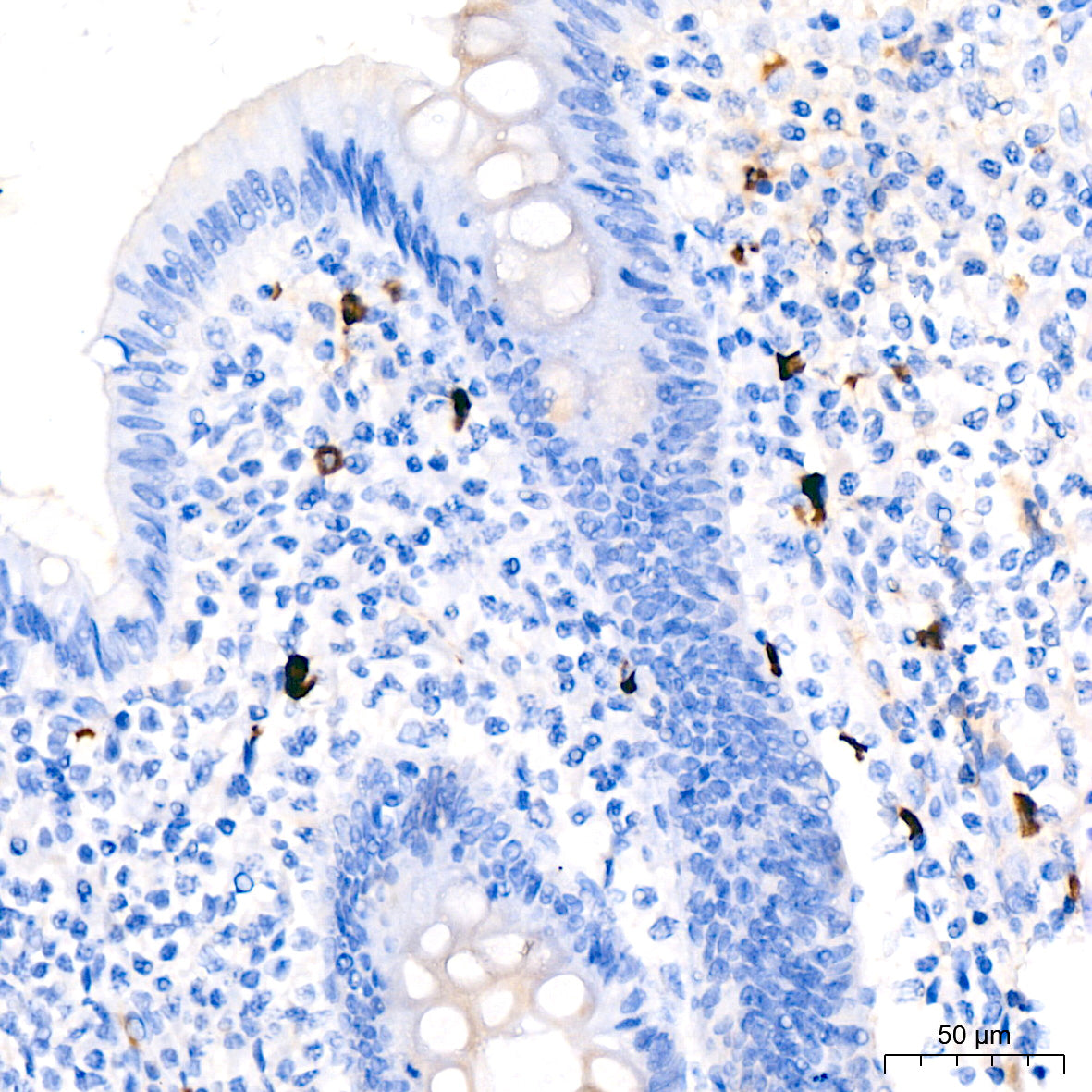 Human IgM Rabbit mAb