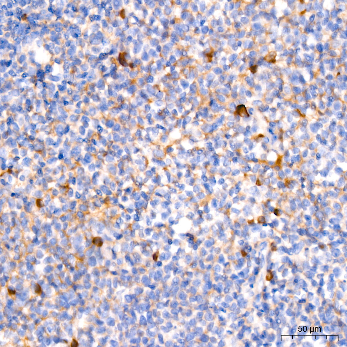 Human IgM Rabbit mAb