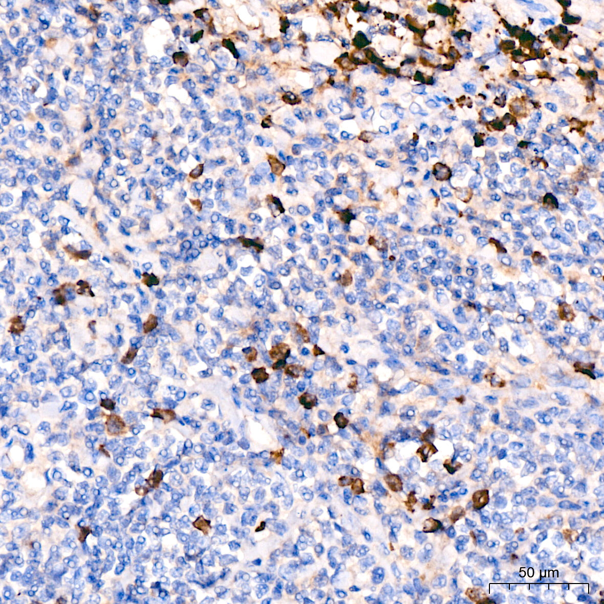Human IgM Rabbit mAb