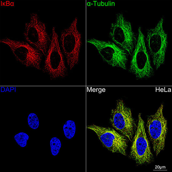 IκBα Rabbit mAb