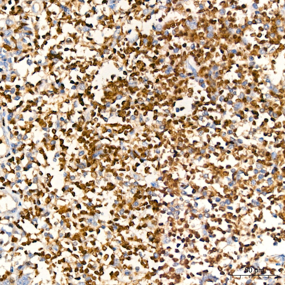 PU.1/SPI1 Rabbit mAb