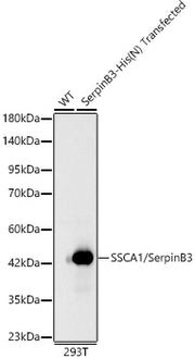 SSCA1/SerpinB3 Rabbit mAb