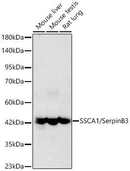 SSCA1/SerpinB3 Rabbit mAb