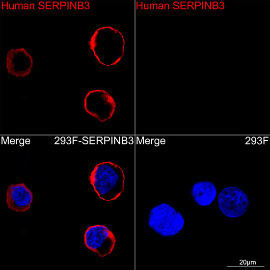 SSCA1/SerpinB3 Rabbit mAb