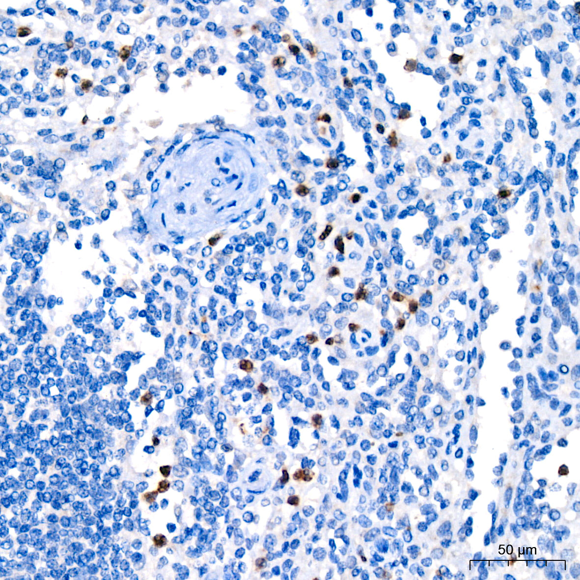 DcR1/CD263 Rabbit mAb