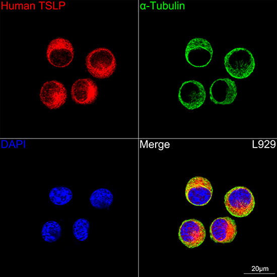 TSLP Rabbit mAb
