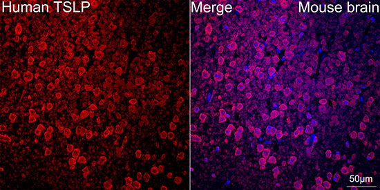 TSLP Rabbit mAb