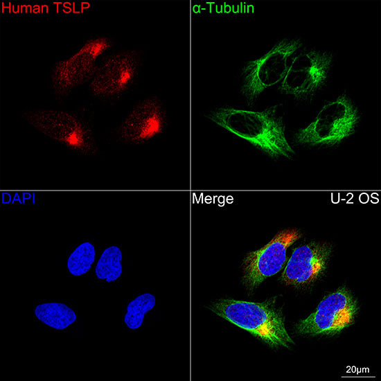 TSLP Rabbit mAb