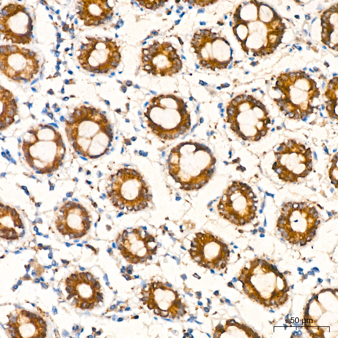 AGMAT Rabbit mAb